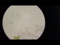 Feeding Rotifer Under Microscope in koi pond