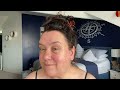 ROSACEA UPDATE (ad/not paid/pr/bought/affiliated links/trackable links/gifts/previouspr)