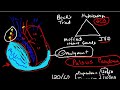 Oncologic Emergencies: Cardiac Tamponade