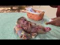Poor Newborn Baby In World Have A Lot Of Injured On Body