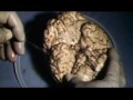 Session II - Changing Your Brain (CBC documentary)