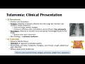 Tularemia (Rabbit Fever) | Causes, Pathogenesis, Forms, Symptoms, Diagnosis, Treatment
