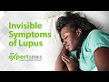 The Expert Series S6E1: Invisible Symptoms of Lupus