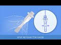 How to use iHealth COVID-19 Antigen Rapid Test Kit Step 3 - Process sample