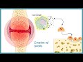 Rheumatoid Arthritis | autoimmune disorder | Pathophysiology, risk factors ,treatment.