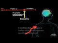 Gate Control Theory of Pain, Animation