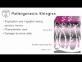 VZV: Pathogenesis & Immune response