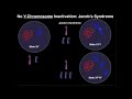 Jacob's Syndrome | A Y-Chromosome Aneuploidy
