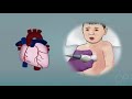 Kawasaki Disease by L. Rubin, L. DiPietro | OPENPediatrics