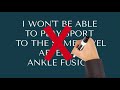 What Can I Do After an Ankle Fusion: 4 Myths About Ankle Fusion