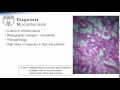 Mucormycosis