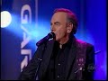 Neil Diamond and Jimmy Kimmel being a Neil impersonator
