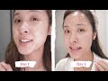 How to REALLY fade Dark Spots that AREN'T Fading (ft. Numbuzin)