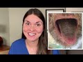 What your TONGUE says about your HEALTH: Doctor Explains