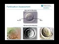 Embryo Selection and Transfer - Mass General Fertility Focus Webinar