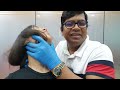 Chiropractic treatment for Severe Neck and Back pain since 1 year.
