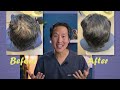 How I Treated My Thinning Hair the Holistic Way!
