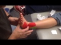 KT TAPE  Lateral Ankle sprain