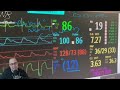 Basic Cardiac Hemodynamics (CVICU/Open Heart Recovery)