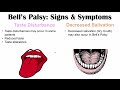 Bell’s Palsy (Facial Paralysis) Signs & Symptoms (& Why They Occur)