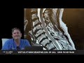 Paralyzed from Epidural Steroid Injection (Ep. 5 Spine Scams Exposed)