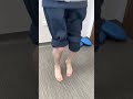Ruptured Achilles Tendon Recovery 8 Months After Surgery