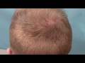 McGrath Medical Ultra Density Hair Transplant Comb through