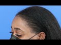 Ashley's Amazing 1 Year Hair Transplant Results for Black Women