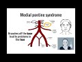 Brainstem Stroke Mnemonics (Memorable Neurology Lecture 15)