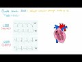 Common ECG abnormalities | MADE EASY!