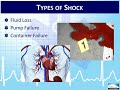 EMT 4-1:  Overview of Shock