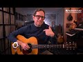 Looking for rhythm ideas?  These simple chord embellishments are a game changer. Guitar Lesson EP566