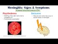 Meningitis Signs and Symptoms (& Why They Occur)