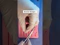 ¿Cómo suturar, paso a paso?