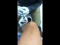 Knee injection