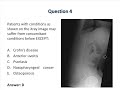 SGH Rheum Rapid Review Series - Ankylosing Spondylitis and Spondyloarthritis