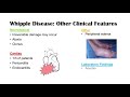 Whipple Disease | Causes, Risk Factors, Pathophysiology, Symptoms, Diagnosis, Treatment