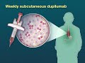 Dupilumab for Eosinophilic Esophagitis | NEJM