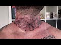 Brutal Neck Tattoo | Time lapse