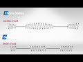 Comparing Cheyne Stokes And Biot's Breathing Patterns - Sounds, Symptoms, and Treatment