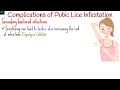 Pubic Lice Infestation (Pubic Crabs): Symptoms, Causes, Treatment, Complications & Prevention