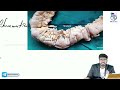 Gastrointestinal Pathology - Crhon's disease, Ulcerative colotis, Colon polyps and Colon cancer