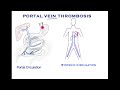 Portal Vein Thrombosis