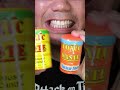 10 Minutes of Satisfying Chewing ASMR #Compilation #ASMR #DoctorTristanPeh