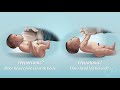 Newborn Exam by N. Gold | OPENPediatrics