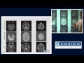 Introducing MRI: Diffusion Imaging (49 of 56)