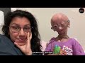 The Girl Who Ages Too Fast (RIP Adalia Rose)