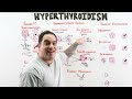 Hyperthyroidism | Clinical Medicine