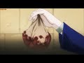 Killua Zoldyck [AMV]   -Without Me-