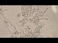 Mikroskopie von Bakterien, Hefen und Pilzen